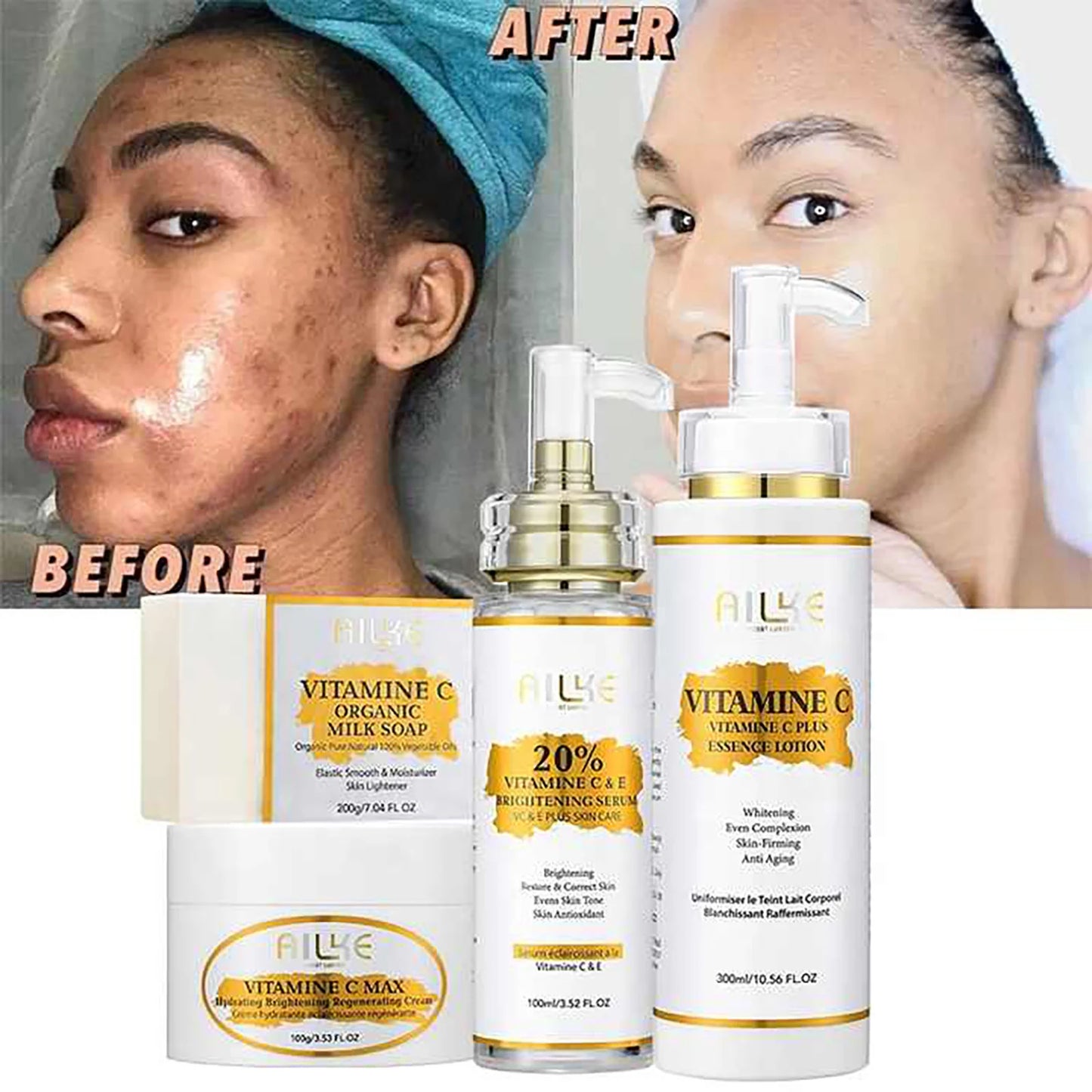 AILKE Lightening Body Cream, With Vitamin C, Hyaluronic Acid, Shea Butter, Reduce Black Spots, Even Skin Tone, Hydration Lotion